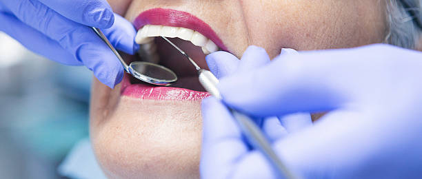 Best Emergency Dentist for Lost Fillings or Crowns in Ckam Housing, HI